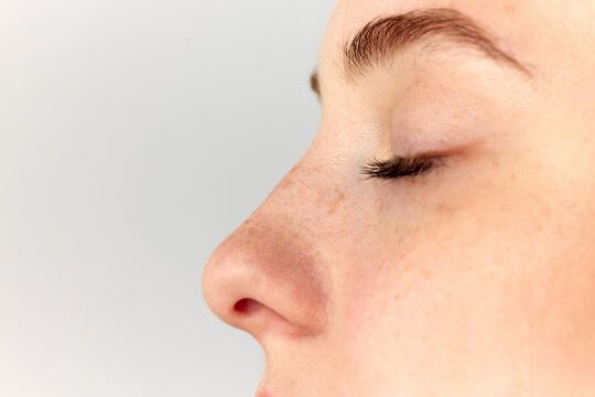 Non-Surgical Rhinoplasty
